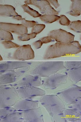 HGF antibody in Mouse Skeletal Muscle by Immunohistochemistry (IHC-Fr).