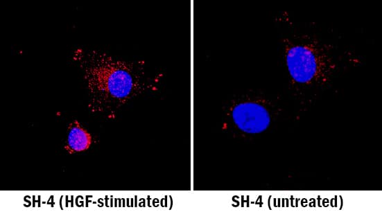 HGF R/c-MET antibody in SH-4 Human Cell Line by Immunocytochemistry (ICC).