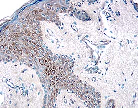 HGF R/c-MET antibody in Human Skin by Immunohistochemistry (IHC-P).