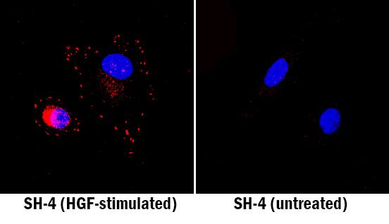 HGF R/c-MET antibody in SH-4 Human Cell Line by Immunocytochemistry (ICC).