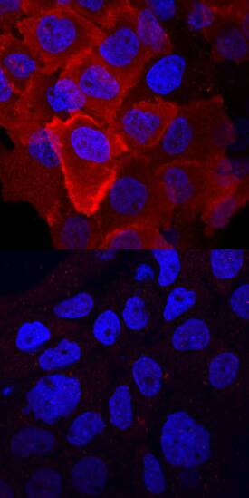 Phospho-HGF R/c-MET (Y1003) antibody in A431 Human Cell Line by Immunocytochemistry (ICC).
