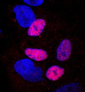 HHEX antibody in iBJ6 iPS Cell Line by Immunocytochemistry (ICC).