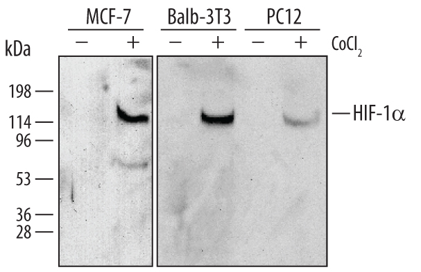 Detection of Human, Mouse, and Rat HIF-1 alpha/HIF1A antibody by Western Blot.