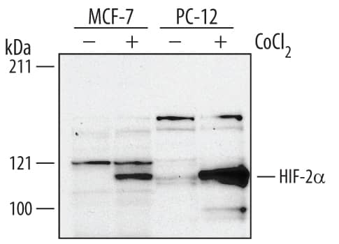 Detection of Human and Rat HIF-2a/EPAS1 antibody by Western Blot.