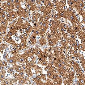 HIF-1 alpha/HIF1A antibody in Human Liver by Immunohistochemistry (IHC-P).
