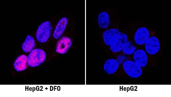 HIF-2a/EPAS1 antibody in HepG2 Human Cell Line by Immunocytochemistry (ICC).