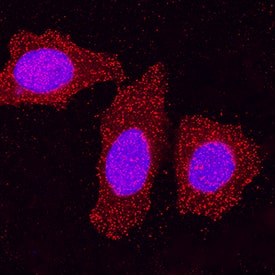 HIPK2 antibody in MCF-7 Human Cell Line by Immunocytochemistry (ICC).