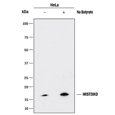 Detection of Human HIST3H3 antibody by Western Blot.