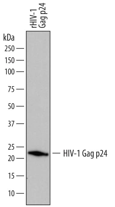 Detection of HIV-1 Gag p24 antibody by Western Blot.