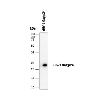 Detection of HIV-1 Gag p24 antibody by Western Blot.