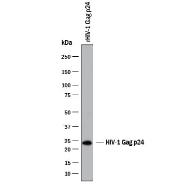 Detection of HIV-1 Gag p24 antibody by Western Blot.
