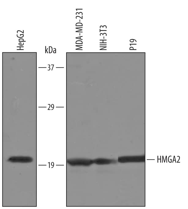 Detection of Human and Mouse HMGA2 antibody by Western Blot.