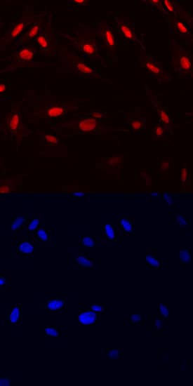 HMGB1/HMG-1 antibody in CCD-18Co Human Cell Line by Immunocytochemistry (ICC).