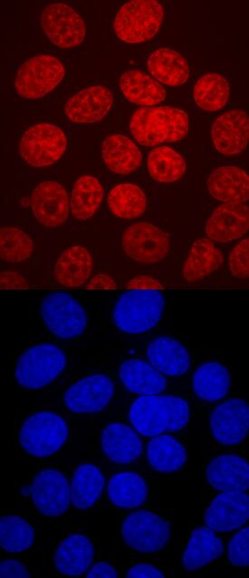 HNF-3a/FoxA1 antibody in MCF-7 Human Cell Line by Immunocytochemistry (ICC).