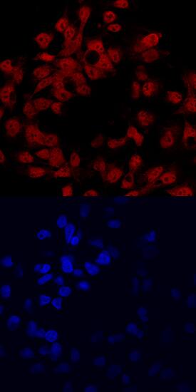 HNF-6/ONECUT1 antibody in HepG2 Human Cell Line by Immunocytochemistry (ICC).
