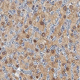 HNF-3 beta/FoxA2 antibody in Human Liver by Immunohistochemistry (IHC-P).