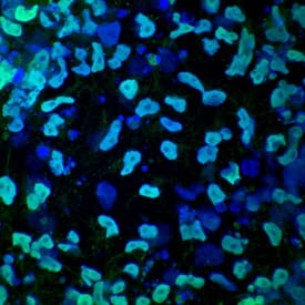 HNF-3 beta/Fox A2 antibody in Mesendoderm Differentiated BG01V Human Stem Cells by Immunocytochemistry (ICC).