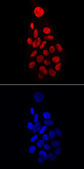 HNF-4a/NR2A1 antibody in HepG2 Human Cell Line by Immunocytochemistry (ICC).