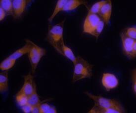 HOIP/RNF31 antibody in MCF-7 Human Cell Line by Immunocytochemistry (ICC).