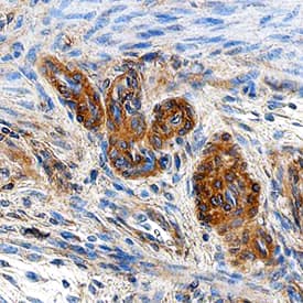 HOIP/RNF31 antibody in Human Uterus by Immunohistochemistry (IHC-P).