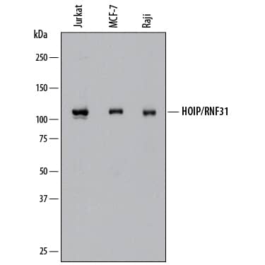 Detection of Human HOIP/RNF31 antibody by Western Blot.