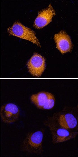 HOIP/RNF31 antibody in MCF-7 Human Cell Line by Immunocytochemistry (ICC).