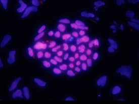 HOXA1 antibody in NTera-2 Human Cell Line by Immunocytochemistry (ICC).