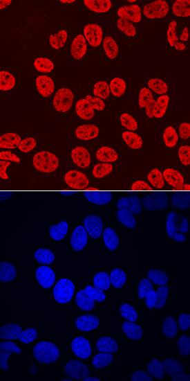 HOXB7 antibody in MCF-7 Human Cell Line by Immunocytochemistry (ICC).