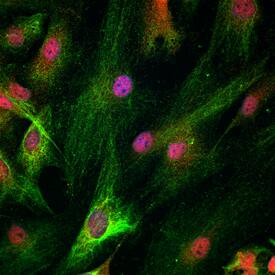 HOXD10 antibody in Human iPS Cells Differentiated to NPCs by Immunocytochemistry (ICC).