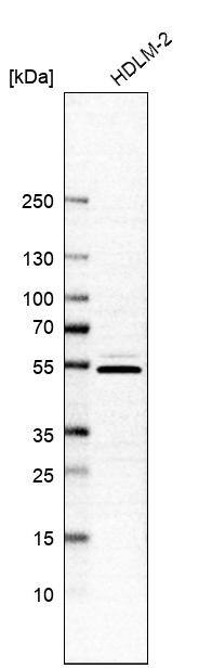 Western Blot: ARID5A Antibody [NBP1-81037]