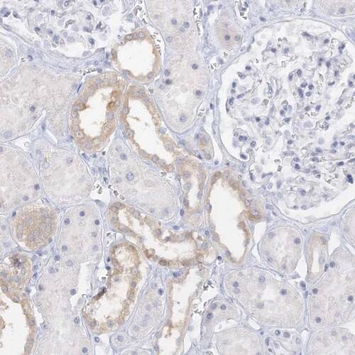 Immunohistochemistry-Paraffin: TRIM2 Antibody [NBP1-81504]