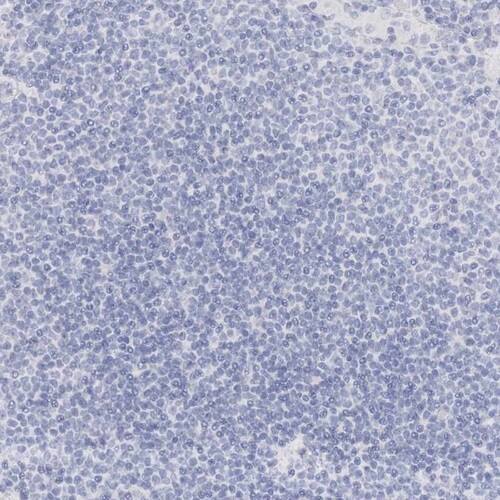 Immunohistochemistry-Paraffin: TRIM2 Antibody [NBP1-81504]