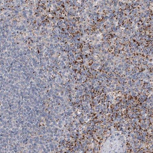 Immunohistochemistry-Paraffin: ALKBH8 Antibody [NBP1-81238]