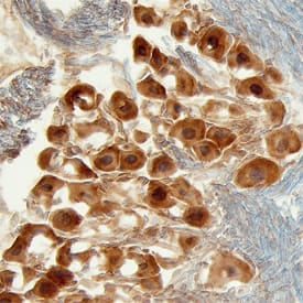 Heparan Sulfate 6-O-Sulfotransferase 3/HS6ST3 antibody in Mouse Brain by Immunohistochemistry (IHC-Fr).