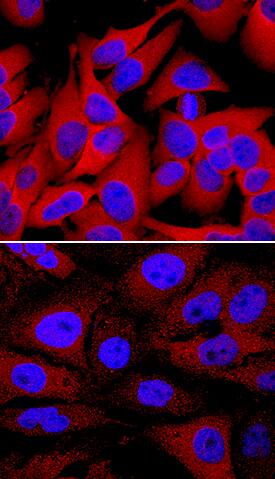 Phospho-HSP27 (S78/S82) antibody in HeLa Human Cell Line by Immunocytochemistry (ICC).