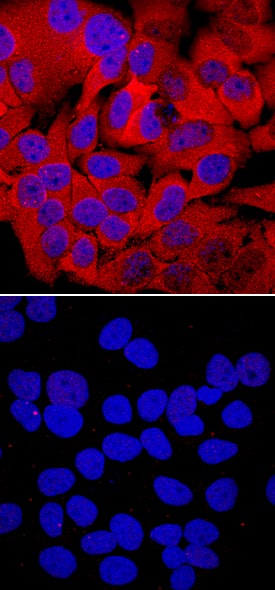 Phospho-HSP27 (S78/S82) antibody in HeLa Human Cell Line by Immunocytochemistry (ICC).