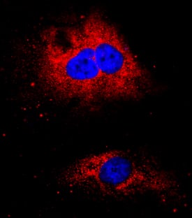 HSP47 antibody in BG01V Human Embryonic Stem Cells by Immunocytochemistry (ICC).