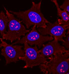 HSPA8/HSC71 antibody in HeLa Human Cell Line by Immunocytochemistry (ICC).