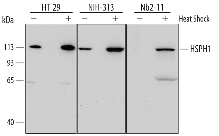 Detection of Human, Mouse, and Rat HSPH1 antibody by Western Blot.