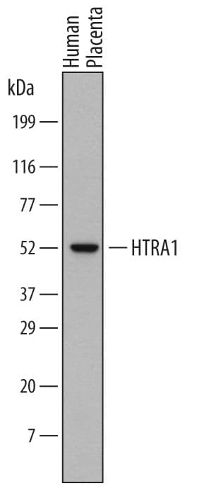 Detection of Human HTRA1/PRSS11 antibody by Western Blot.