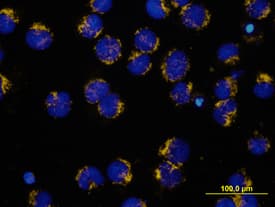 HTRA2/Omi antibody in Jurkat Human Cell Line by Immunocytochemistry (ICC).