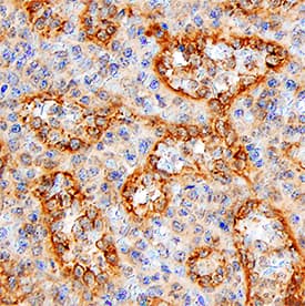 HVEM/TNFRSF14 antibody in Human Spleen by Immunohistochemistry (IHC-P).