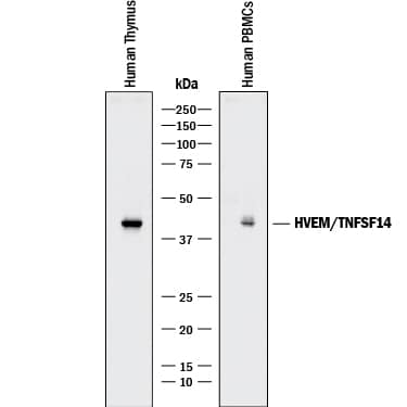 Detection of Human HVEM/TNFRSF14 antibody by Western Blot.