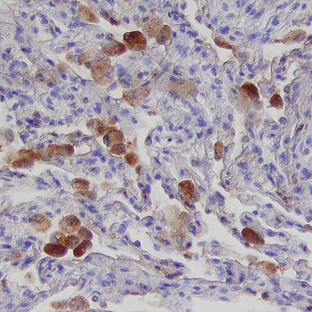 HVEM/TNFRSF14 antibody in Human Lung by Immunohistochemistry (IHC-P).