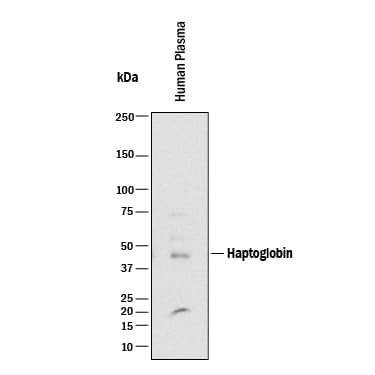 Detection of Human and Mouse Haptoglobin antibody by Western Blot.