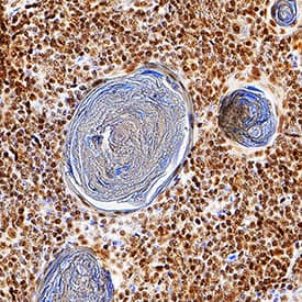 Helios antibody in Human Thymus by Immunohistochemistry (IHC-P).