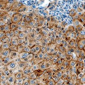Hemopexin antibody in Human Liver by Immunohistochemistry (IHC-P).