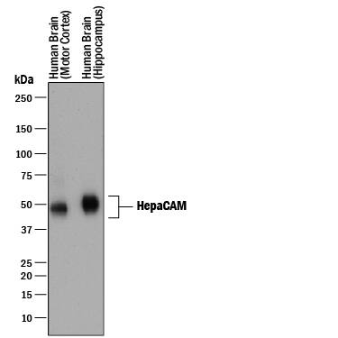 Detection of Human HepaCAM antibody by Western Blot.