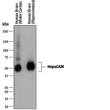 Detection of Human HepaCAM antibody by Western Blot.