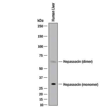 Detection of Human Hepassocin antibody by Western Blot.